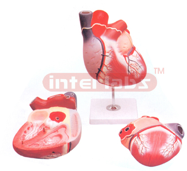 HUMAN HEART, 2 PARTS